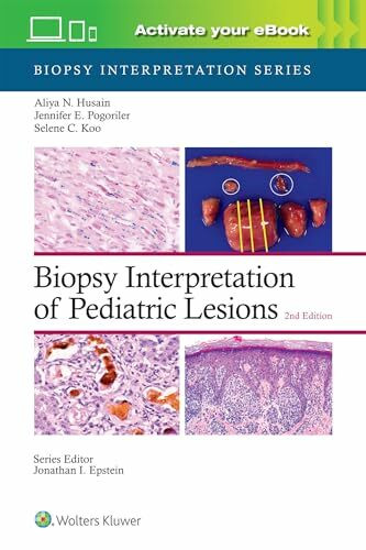 Biopsy Interpretation of Pediatric Lesions: Biopsy Interpretation Series