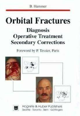 Orbital Fractures: Diagnosis,, Operative Treatment, Secondary Corrections Orbital Fractures: Diagnosis,, Operative Treatment, Secondary Corrections