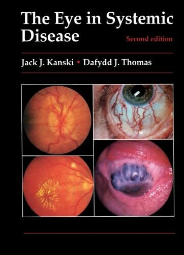 The Eye in Systemic Disease: Second Edition