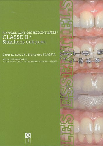 Propositions Orthodontiques, Classe II, Situations Critiques: Les Essentiels