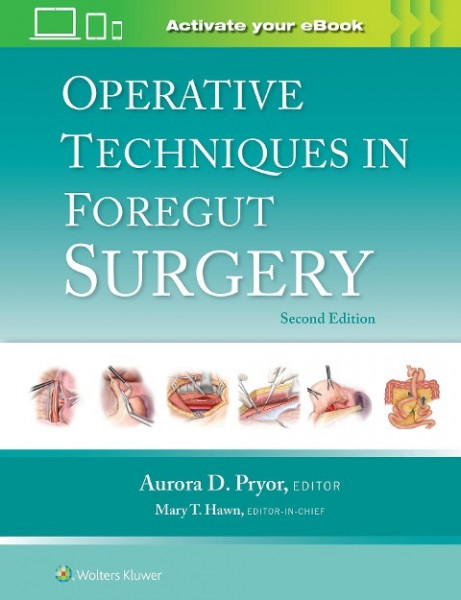 Operative Techniques in Foregut Surgery