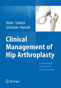 Clinical Management of Hip Arthroplasty