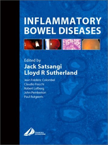 Inflammatory Bowel Disease
