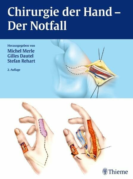 Chirurgie der Hand: Der Notfall