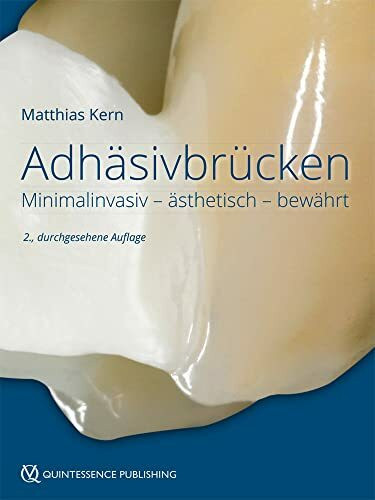 Adhäsivbrücken: Minimalinvasiv - ästhetisch - bewährt