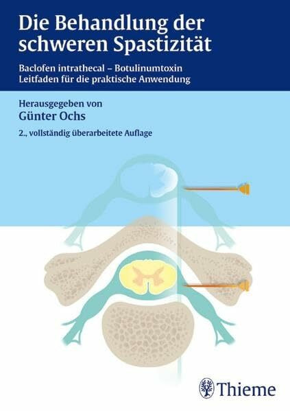 Die Behandlung der schweren Spastizität: Baclofen intrathecal - Botulinumtoxin Leitfaden für die praktische Anwendung