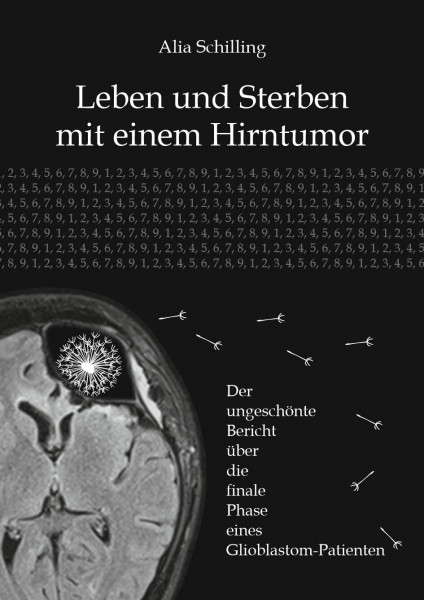 Leben und Sterben mit einem Hirntumor: Der ungeschönte Bericht über die finale Phase eines Glioblastom-Patienten
