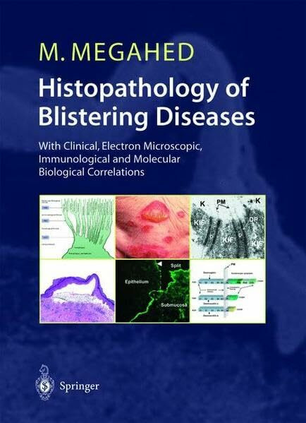 Histopathology of Blistering Diseases: With Clinical, Electron Microscopic, Immunological and Molecular Biological Correlations Textbook and Atlas (Advanced Texts in Physics)