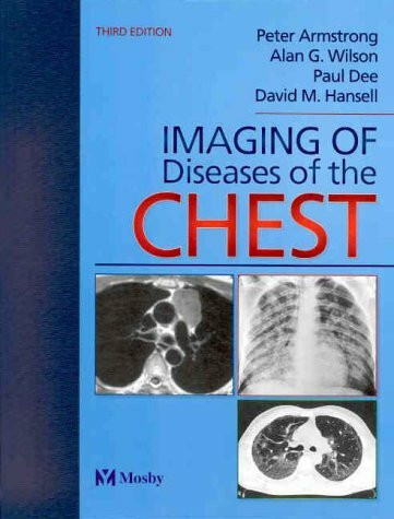 Imaging of Diseases of the Chest