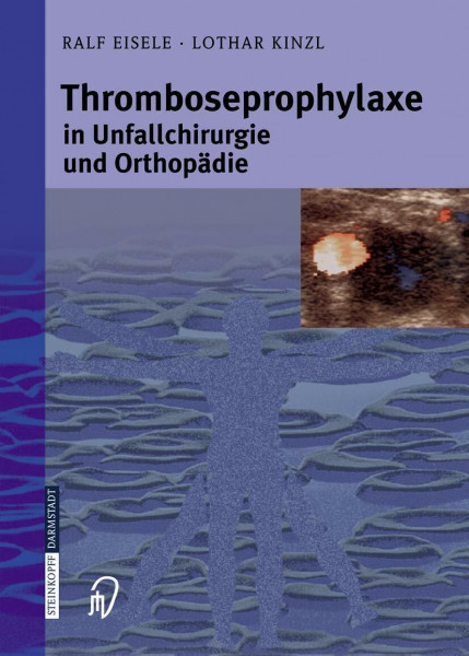 Thromboseprophylaxe in Unfallchirurgie und Orthopädie