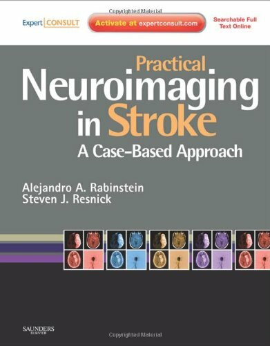 Practical Neuroimaging in Stroke: A Case-Based Approach