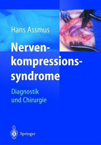 Nerven-kompressions-syndrome: Diagnostik und Chirurgie Nerven-kompressions-syndrome: Diagnostik und Chirurgie
