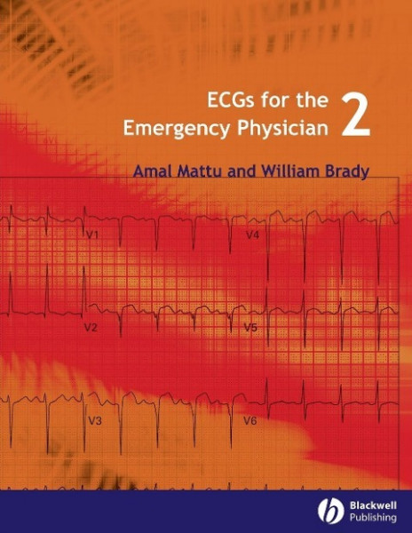 ECGs for the Emergency Physici