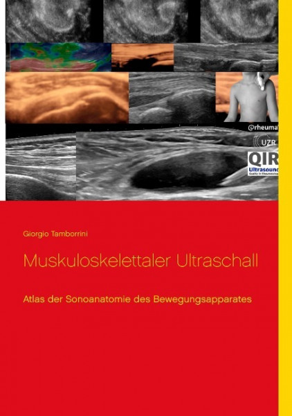 Muskuloskelettaler Ultraschall