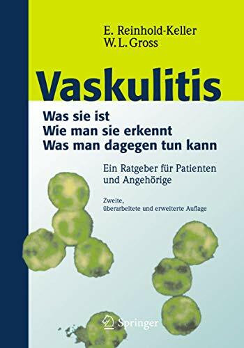 Vaskulitis: Was ist sie - Wie man sie erkennt - Was man dagegen tun kann