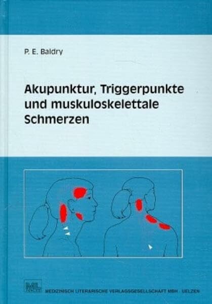Akupunktur, Triggerpunkte und muskoskelettale Schmerzen: Eine an der westlichen Schulmedizin orientierte Form der Akupunktur für Ärzte und ... Behandlung myofaszialer Triggerpunktschmerzen