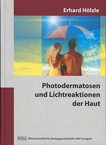 Photodermatosen und Lichtreaktionen der Haut