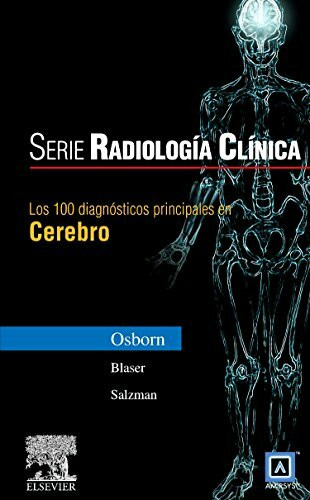 Los 100 diagnósticos principales en cerebro (Serie Pocket de Radiologia)
