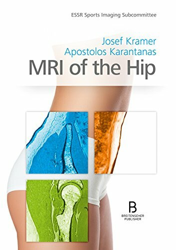 MRI of the Hip
