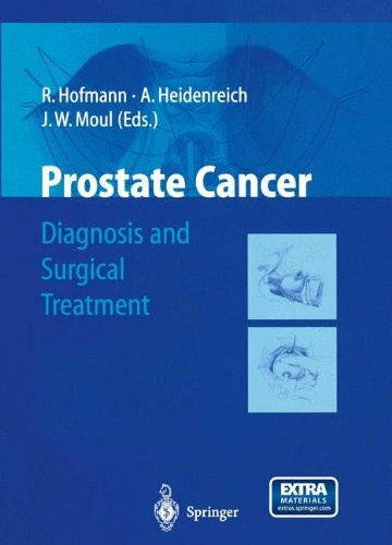 Prostate Cancer: Diagnosis and Surgical Treatment