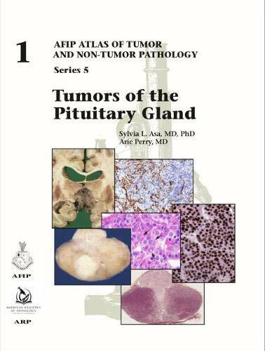 Tumors of the Pituitary Gland (AFIP Atlas of Tumor and Non-Tumor Pathology, Series 5, Band 1)