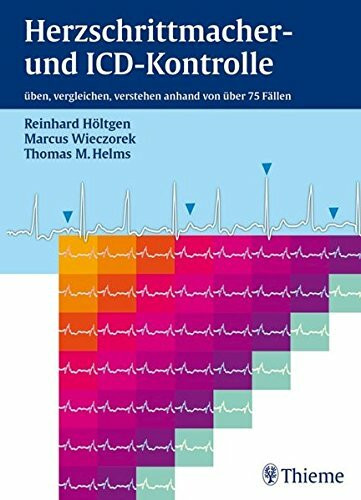 Herzschrittmacher- und ICD-Kontrolle: üben, vergleichen, verstehen anhand von 76 Fällen: Üben, vergleichen, verstehen anhand von über 75 Fällen