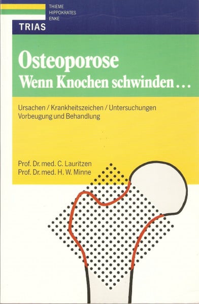 Osteoporose: Wenn Knochen schwinden...: Ursachen, Krankheitszeichen, Untersuchungen. Vorbeugung und Behandlung