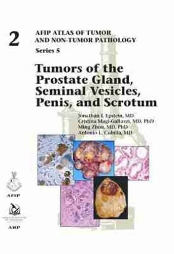 Tumors of the Prostate Gland, Seminal Vesicles, Penis, and Scrotum (AFIP Atlas of Tumor and Non-Tumor Pathology, Series 5, Band 2)