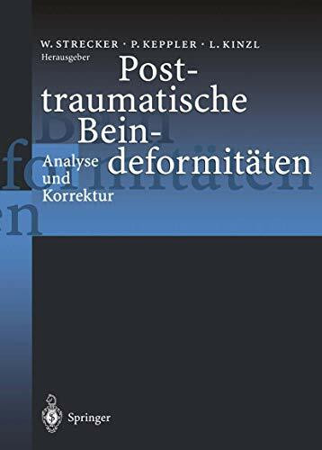 Posttraumatische Beindeformitäten: Analyse und Korrektur