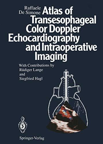 Atlas of Transesophageal Color Doppler Echocardiography and Intraoperative Imaging Atlas of Transesophageal Color Doppler Echocardiography and Intraoperative Imaging