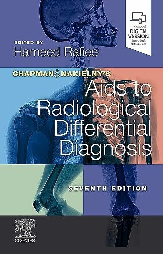 Chapman & Nakielny's Aids to Radiological Differential Diagnosis: Expert Consult - Online and Print