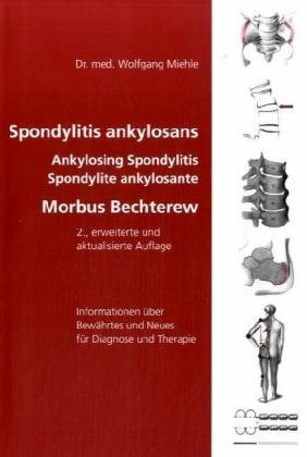 Spondylitis ankylosans - Morbus Bechterew