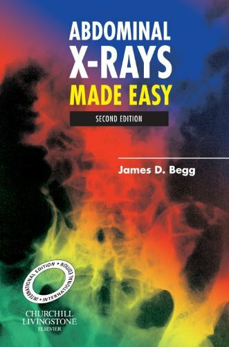 Abdominal X-Rays Made Easy, International Edition, Second Edition