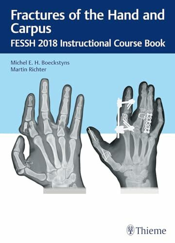 Fractures of the Hand and Carpus