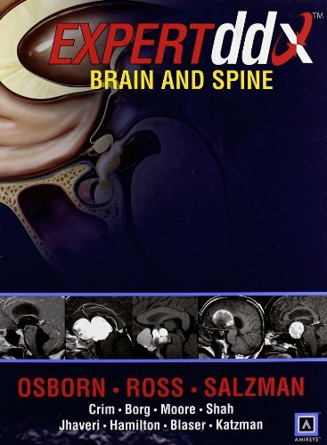 Brain and Spine (Expert Differential Diagnoses)