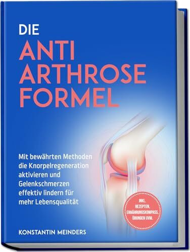 Die Anti Arthrose Formel: Mit bewährten Methoden die Knorpelregeneration aktivieren und Gelenkschmerzen effektiv lindern für mehr Lebensqualität - inkl. Rezepten, Ernährungskompass, Übungen uvm.