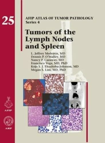 Tumors of the Lymph Nodes and Spleen (AFIP Atlas of Tumor Pathology, Series 4,)