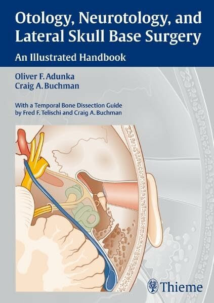 Otology, Neurotology, and Lateral Skull-Base Surgery:: An Illustrated Handbook