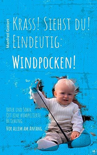 Krass! Siehst du! Eindeutig: Windpocken!