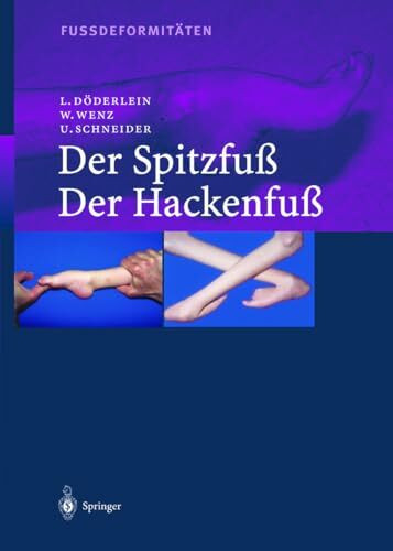 Fussdeformitäten: Der Spitzfuß / Der Hackenfuß