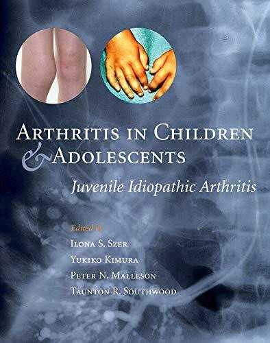 Arthritis in Children and Adolescents: Juvenile Idiopathic Arthritis