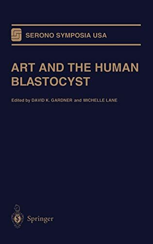 ART and the Human Blastocyst (Serono Symposia USA)
