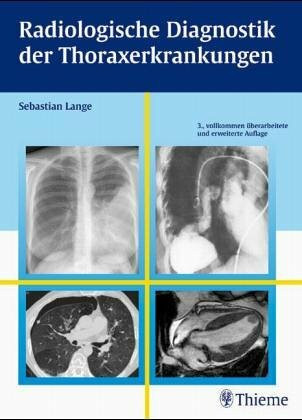Radiologische Diagnostik der Lungenerkrankungen