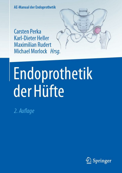 Endoprothetik der Hüfte (AE-Manual der Endoprothetik)