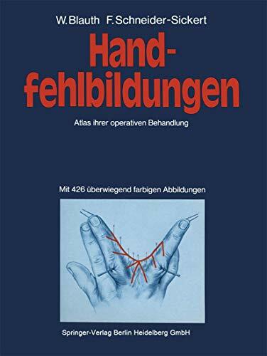 Handfehlbildungen: Atlas ihrer operativen Behandlung Handfehlbildungen: Atlas ihrer operativen Behandlung