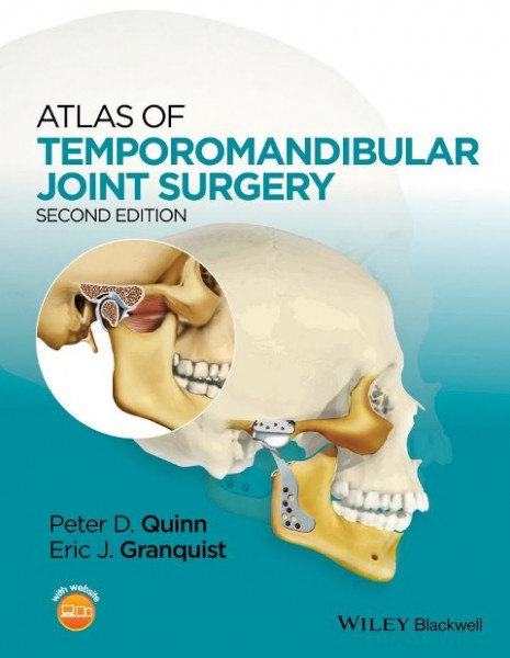 Atlas of Temporomandibular Joint Surgery, 2e