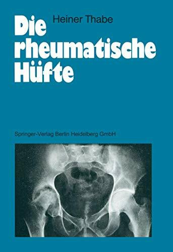 Die rheumatische Hüfte (German Edition)