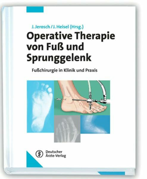 Operative Therapie von Fuß und Sprunggelenk: Fußchirurgie in Klinik und Praxis
