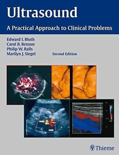 Ultrasound: A Practical Approach to Clinical Problems (THIEME PUBLISHERS) Ultrasound: A Practical Approach to Clinical Problems (THIEME PUBLISHERS)