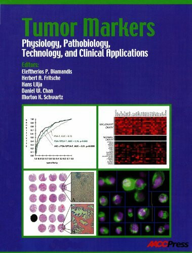 Tumor Markers: Physiology, Pathobiology, Technology, and Clinical Applications